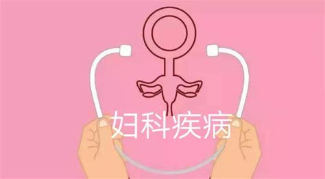 婦科病|妇科疾病（病症名称）